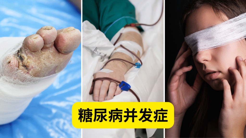 糖尿病并发症