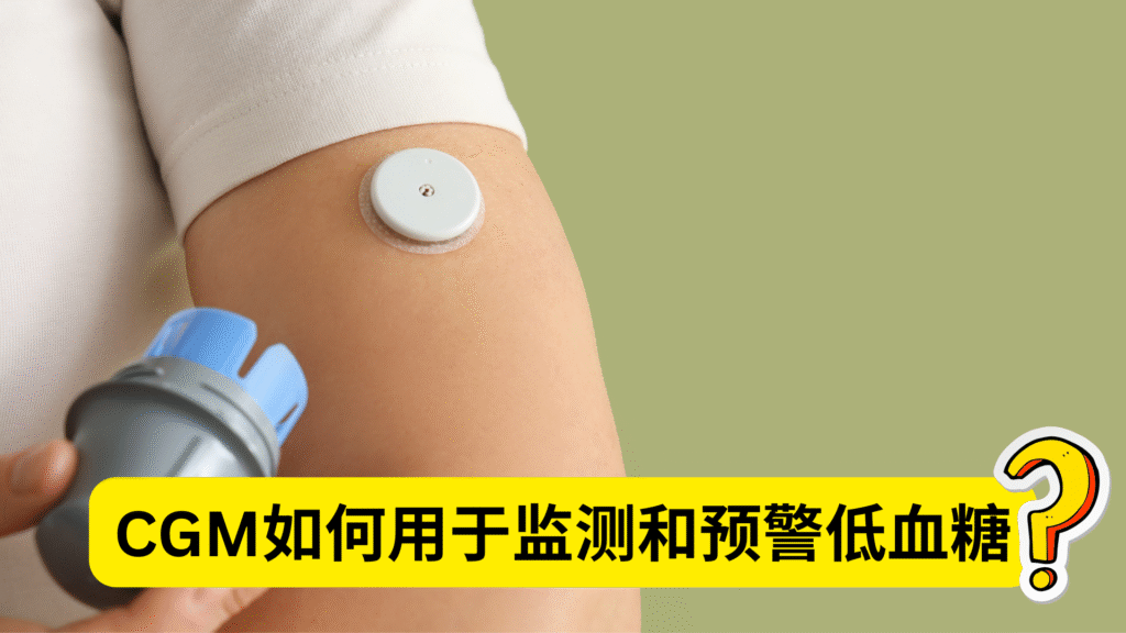 CGM如何用于监测和预警低血糖